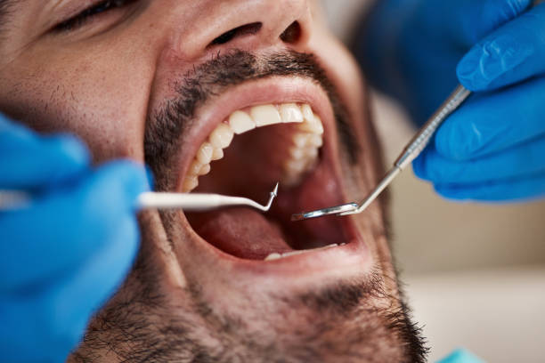 Best Emergency Denture Repair in St Peter, MN